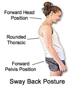 How Your Posture is Affecting Your SP