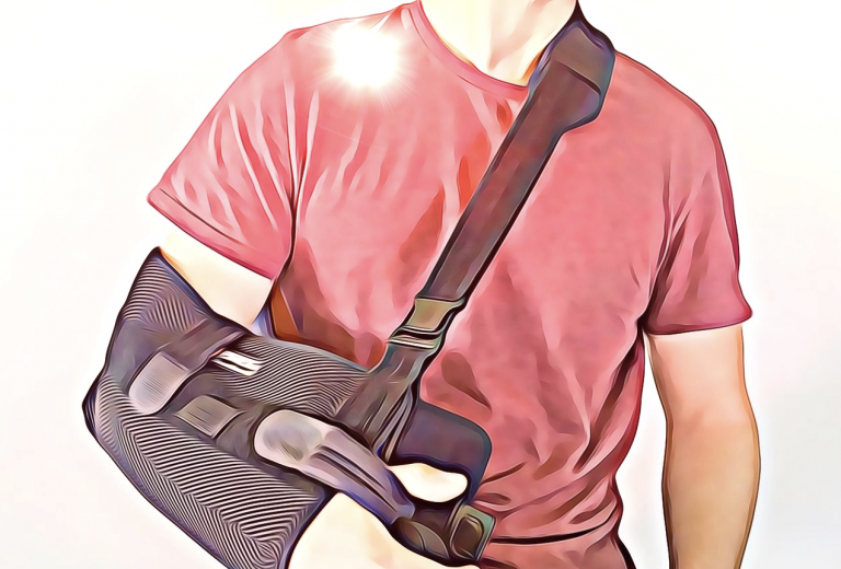 Focus The Broken Collarbone Cumberland Physiotherapy Sport